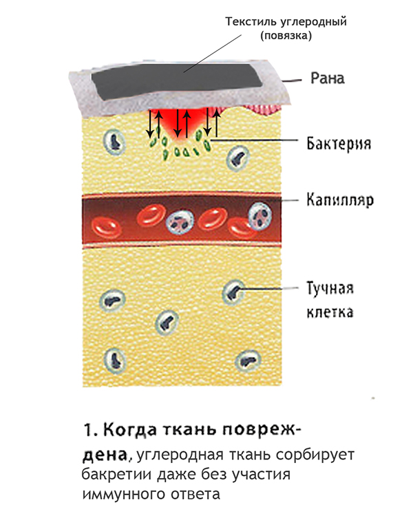 treatment of burns and bedsores with textile bandages - 2