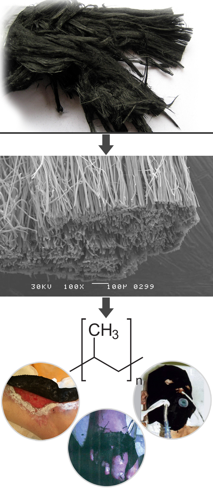 treatment of burns and bedsores with textile bandages for bedridden patients